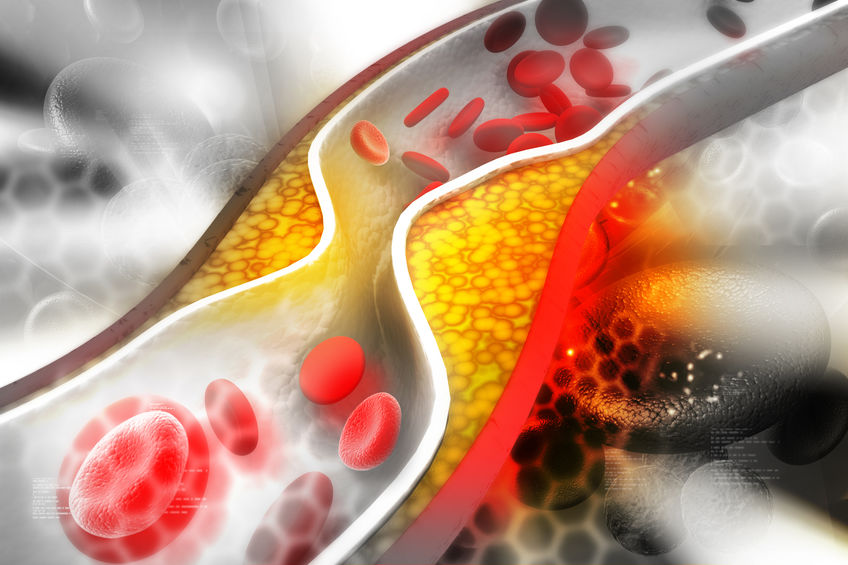 doenças cardiovasculares